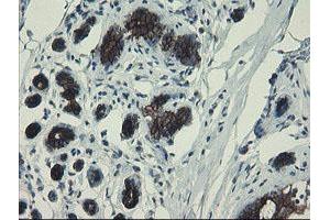Immunohistochemical staining of paraffin-embedded Human breast tissue using anti-DPH2 mouse monoclonal antibody.
