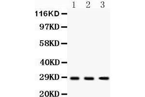 Western Blotting (WB) image for anti-Dickkopf 2 Homolog (DKK2) (AA 34-259) antibody (ABIN3043565) (DKK2 antibody  (AA 34-259))