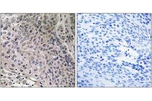 Immunohistochemistry (IHC) image for anti-Prostaglandin E Synthase 3 (Cytosolic) (PTGES3) (AA 79-128) antibody (ABIN2888705) (PTGES3 antibody  (AA 79-128))