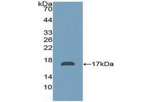 WB of Protein Standard: different control antibodies against Highly purified E. (AZGP1 ELISA Kit)