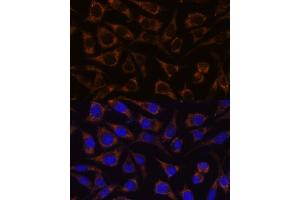 Immunofluorescence analysis of L929 cells using GTPBP8 antibody (ABIN7267527) at dilution of 1:100.