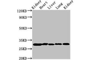 Western Blot Positive WB detected in: Rat kidney tissue, Rat heart tissue, Rat liver tissue, Mouse lung tissue, Mouse kidney tissue All lanes: CA2 antibody at 2 μg/mL Secondary Goat polyclonal to rabbit IgG at 1/50000 dilution Predicted band size: 30 kDa Observed band size: 30 kDa (CA2 antibody  (AA 2-260))