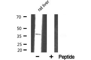 Western blot analysis of Annexin III Antibody expression in rat liver tissue lysates. (Annexin A3 antibody  (N-Term))