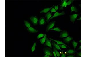 Immunofluorescence of monoclonal antibody to WASL on HeLa cell.