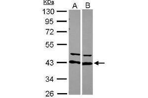 WB Image Sample (30 ug of whole cell lysate) A: 293T B: Raji 10% SDS PAGE antibody diluted at 1:10000 (HNRNPD/AUF1 antibody)
