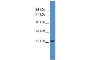 Host:  Rabbit  Target Name:  DKFZp686H10114  Sample Type:  COLO205 Whole cell lysates  Antibody Dilution:  1. (DKFZp686H10114 (Middle Region) antibody)