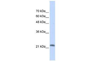 RASL10A antibody used at 1 ug/ml to detect target protein. (RASL10A antibody  (N-Term))