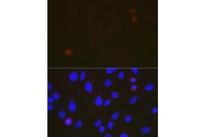Immunofluorescence analysis of C6 cells using T Rabbit mAb (ABIN7270916) at dilution of 1:100 (40x lens). (TACC3 antibody)