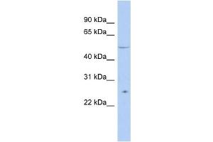 TTC8 antibody used at 1 ug/ml to detect target protein.