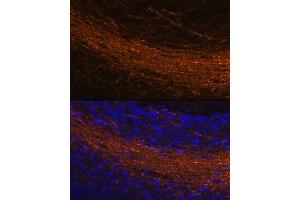 Immunofluorescence analysis of rat brain using CNPase Rabbit mAb (ABIN7265322) at dilution of 1:100 (40x lens). (Cnpase antibody)