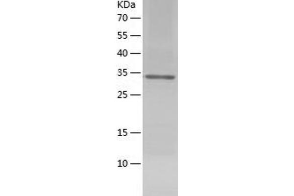 Dystroglycan Protein (AA 30-312) (His tag)