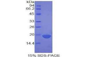 SDS-PAGE (SDS) image for Fibrillin 1 (FBN1) (AA 1475-1638) protein (His tag) (ABIN2121038) (Fibrillin 1 Protein (FBN1) (AA 1475-1638) (His tag))