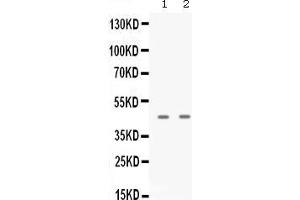 Western blot analysis of APOBEC3G expression in A431 whole cell lysates ( Lane 1), and JURKAT whole cell lysates ( Lane 2). (APOBEC3G antibody  (AA 191-384))