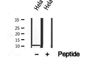 Western blot analysis of extracts from Hela, using S100A14 antibody. (S100A14 antibody  (N-Term))