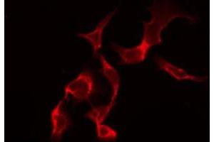 ABIN6268965 staining HuvEc by IF/ICC. (HNRNPD/AUF1 antibody  (Internal Region))