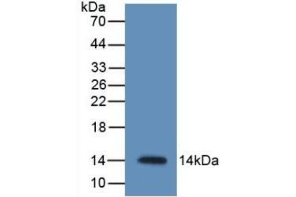 Resistin anticorps  (AA 21-114)