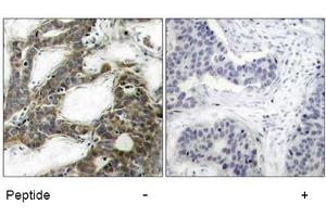 Image no. 1 for anti-Catenin (Cadherin-Associated Protein), beta 1, 88kDa (CTNNB1) (Ser33) antibody (ABIN197444)