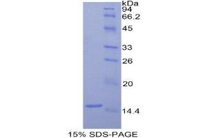 SDS-PAGE (SDS) image for Coagulation Factor VII (F7) (AA 315-433) protein (His tag) (ABIN1877301) (Factor VII Protein (AA 315-433) (His tag))