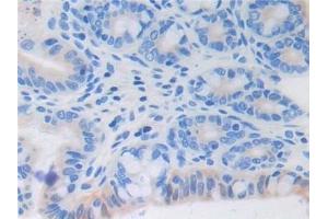 Detection of FGF6 in Mouse Small intestine Tissue using Polyclonal Antibody to Fibroblast Growth Factor 6 (FGF6)