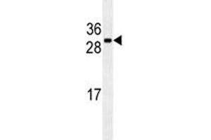 CDCA8 antibody western blot analysis in U251 lysate (CDCA8 antibody)