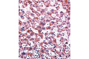 CYP2C9 Antibody immunohistochemistry analysis in formalin fixed and paraffin embedded human liver tissue followed by peroxidase conjugation of the secondary antibody and DAB staining. (CYP2C9 antibody  (N-Term))