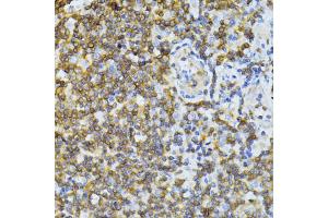 Immunohistochemistry of paraffin-embedded human tonsil using ND5 antibody (ABIN6294088) at dilution of 1:100 (40x lens). (MT-ND5 antibody)