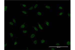 Immunofluorescence of monoclonal antibody to ZBTB20 on HeLa cell. (ZBTB20 antibody  (AA 451-542))