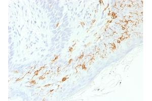 Formalin-fixed, paraffin-embedded human Skin stained with CD1a-Monospecific RecombinantRabbit Monoclonal Antibody (C1A/1506R).