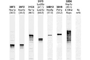 The Western blots of whole yeast protein extracts with a collection of our antibodies. (PDI1 antibody)