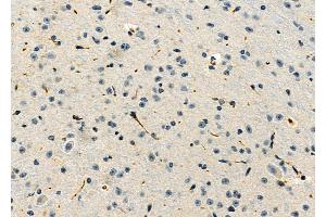 ABIN6263343 and ABIN6276818 at 1/100 staining Mouse brain tissue by IHC-P.