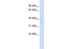 PGBD2 antibody used at 1 ug/ml to detect target protein. (PGBD2 antibody  (Middle Region))