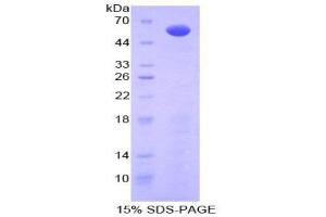 SDS-PAGE (SDS) image for Interleukin 10 Receptor, alpha (IL10RA) (AA 17-241) protein (His tag,GST tag) (ABIN2123070)