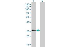 Western Blot analysis of KLK7 expression in transfected 293T cell line by KLK7 MaxPab polyclonal antibody. (Kallikrein 7 antibody  (AA 1-253))