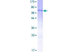 Factor VII Protein (AA 1-444) (GST tag)