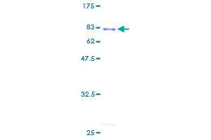 TADA3L Protein (AA 1-432) (GST tag)