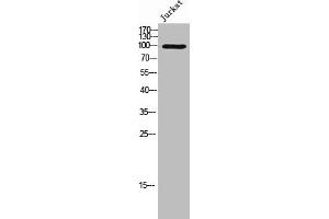 Western Blot analysis of JK cells using Phospho-Vav3 (Y173) Polyclonal Antibody