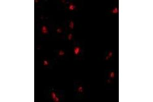 Immunofluorescence of cbl in human lymph node tissue with AP30209PU-N cbl antibody at 20 μg/ml. (CBL antibody  (C-Term))