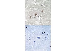 Immunohistochemical staining of human brain tissue by MAP3K1 (phospho T1400) polyclonal antibody  without blocking peptide (A) or preincubated with blocking peptide (B). (MAP3K1 antibody  (pThr1400))