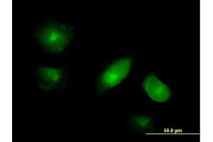 Immunofluorescence of purified MaxPab antibody to VAC14 on HeLa cell.