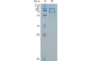 Selectin P Ligand (SELPLG) (AA 34-356) protein (His tag)