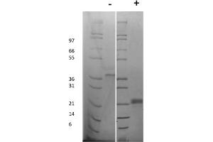 SDS-PAGE of Rat Vascular Endothelial Growth Factor-165 Recombinant Protein SDS-PAGE of Rat Vascular Endothelial Growth Factor-165 Recombinant Protein. (VEGFA Protein)