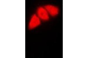 Immunofluorescent analysis of p53 staining in HeLa cells. (p53 antibody  (N-Term))