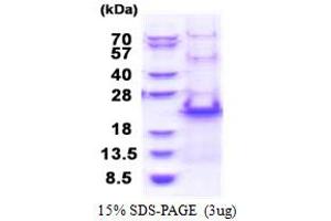 SDS-PAGE (SDS) image for Ribosomal Protein S20 (RPS20) (AA 1-142) protein (His tag) (ABIN5853428)