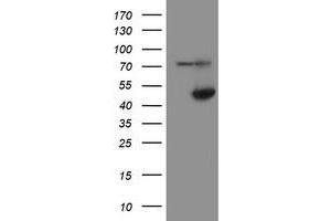 HEK293T cells were transfected with the pCMV6-ENTRY control (Left lane) or pCMV6-ENTRY ADH7 (Right lane) cDNA for 48 hrs and lysed. (ADH7 antibody)