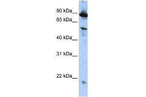 ZGPAT antibody  (N-Term)