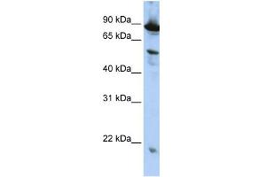WB Suggested Anti-ZGPAT Antibody Titration:  0.