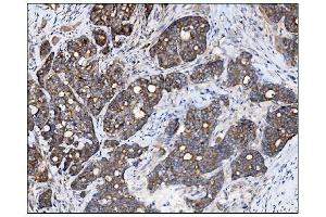 IHC analysis of AS160/TBC1D4 using anti-AS160/TBC1D4 antibody (ABIN7599745). (TBC1D4 antibody  (AA 1118-1298))
