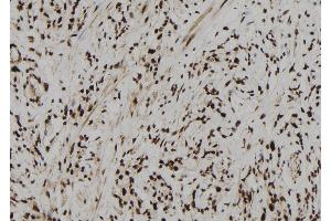 ABIN6273104 at 1/100 staining Human gastric tissue by IHC-P. (CPSF4 antibody  (C-Term))