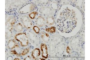 Immunoperoxidase of monoclonal antibody to TIMP2 on formalin-fixed paraffin-embedded human kidney. (TIMP2 antibody  (AA 27-220))
