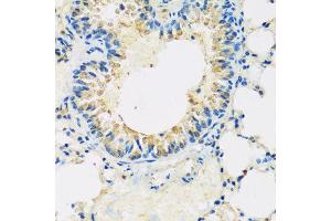 Immunohistochemistry of paraffin-embedded mouse lung using ABCF2 antibody at dilution of 1:100 (x40 lens).